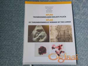 Atlas tromboembolijske bolesti pluća