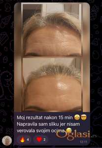 Skinite obim sa aparatom 12dhifu