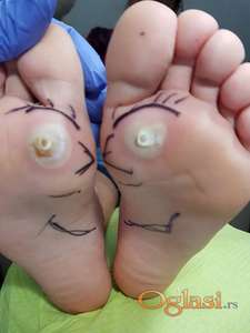 Nega stopala, za starija lica