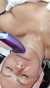 Hifu aparat saradnja sa salonima