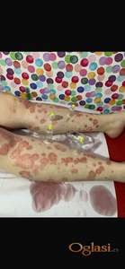 Hidzamom do balansa, Jaca