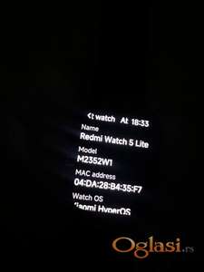 Redmi watch 5 lite